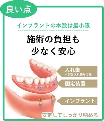 良い点：インプラントの本数は最小限。背術の負担も少なく安心