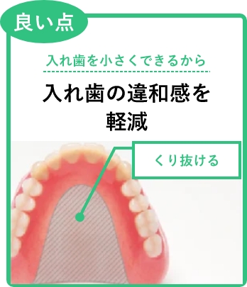 良い点：入れ歯を小さくできるから。入れ歯の違和感を軽減