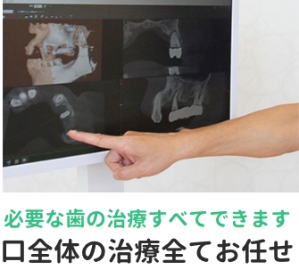 必要な歯の治療すべてできます。口全体の治療全てお任せ