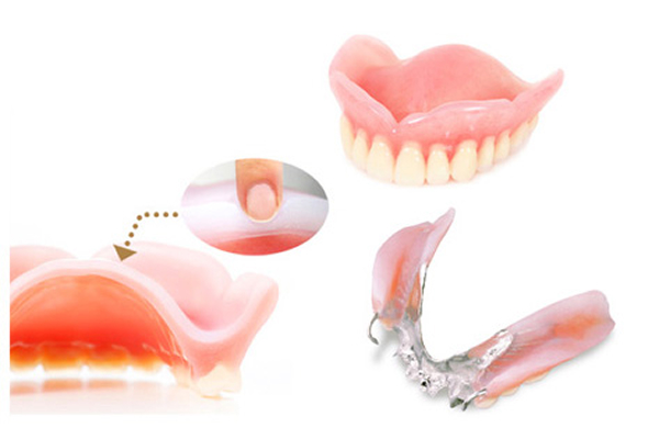 やわらかい入れ歯