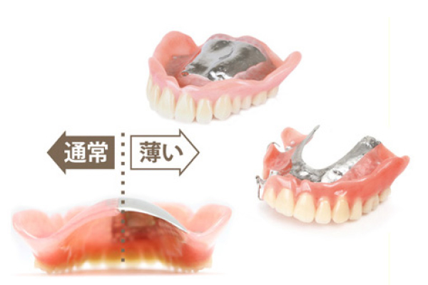 金属の入れ歯