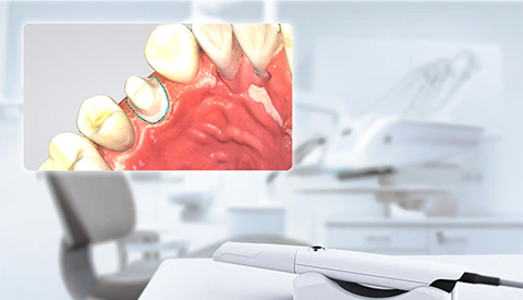 経過観察・検査